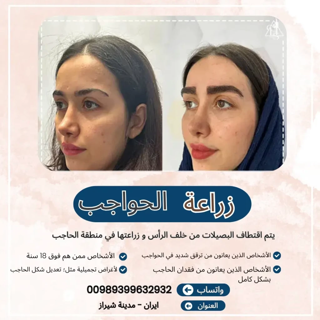 تكلفة زراعة الحواجب في ايران