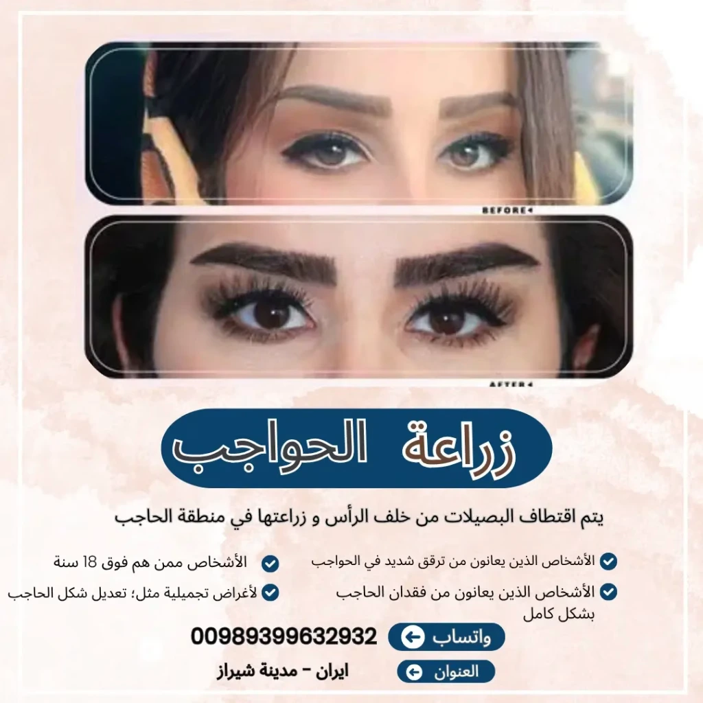 تكلفة زراعة الحواجب في شيراز