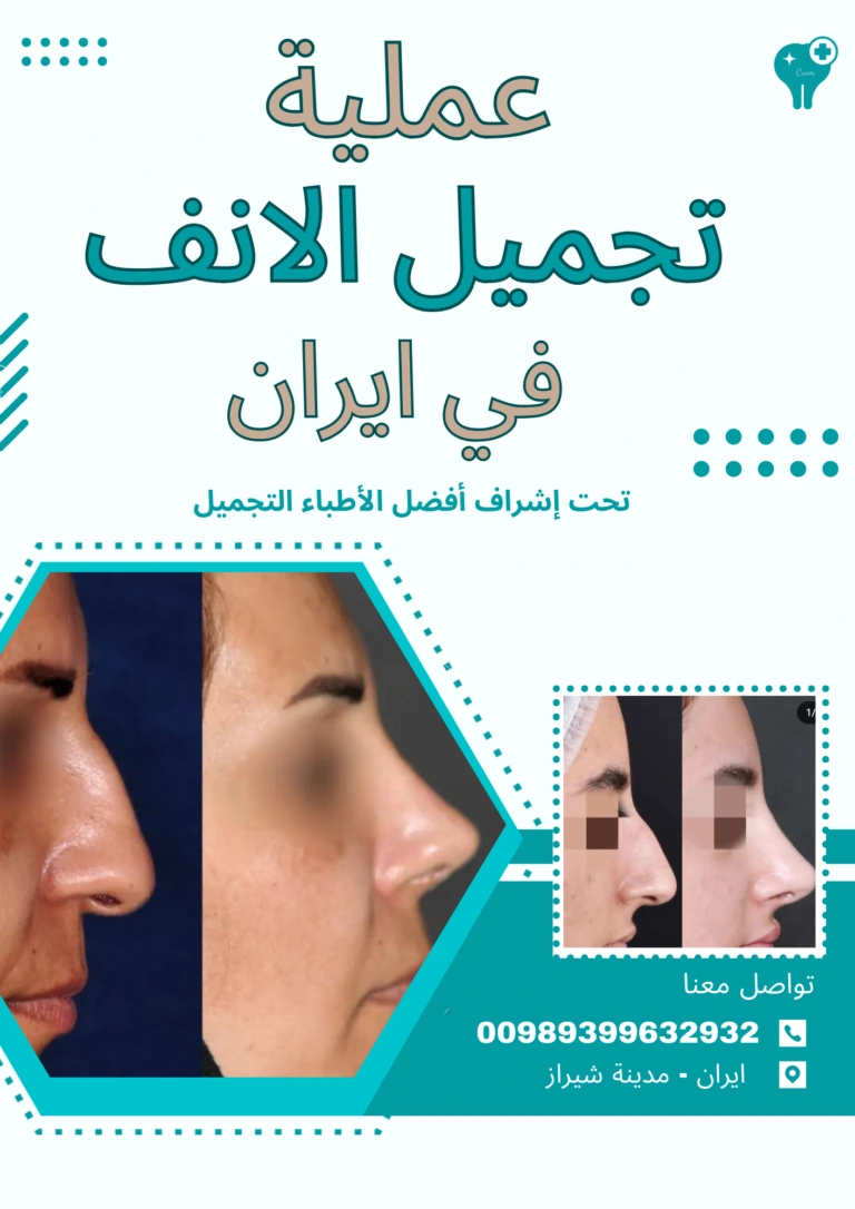 تكلفة-عملية-الانف-في-ايران