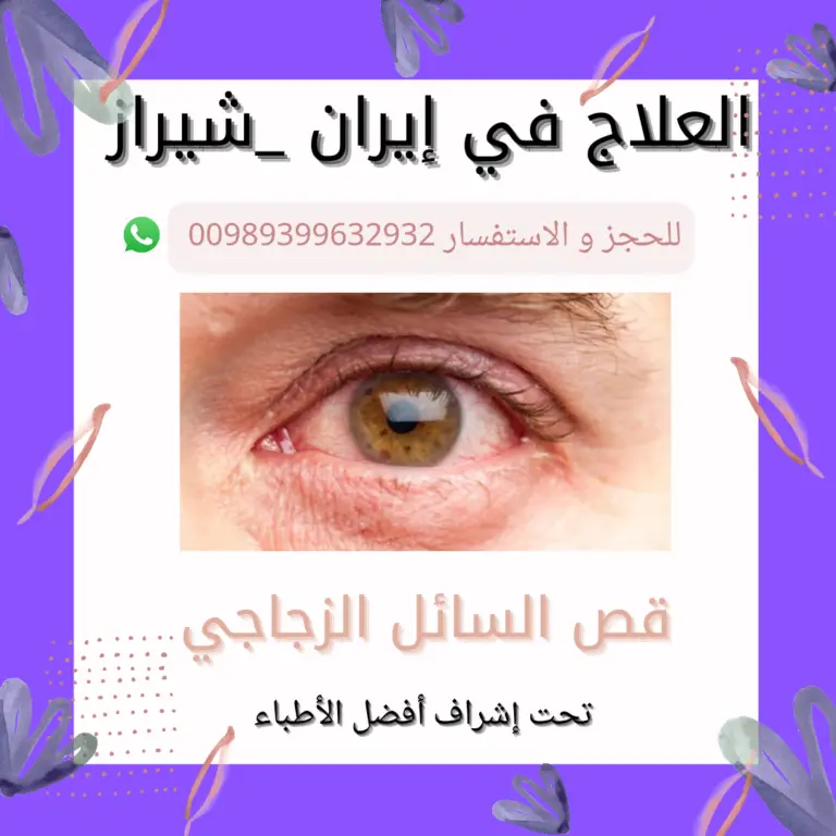 تكلفة-عملية-الشبكية-في-ايران