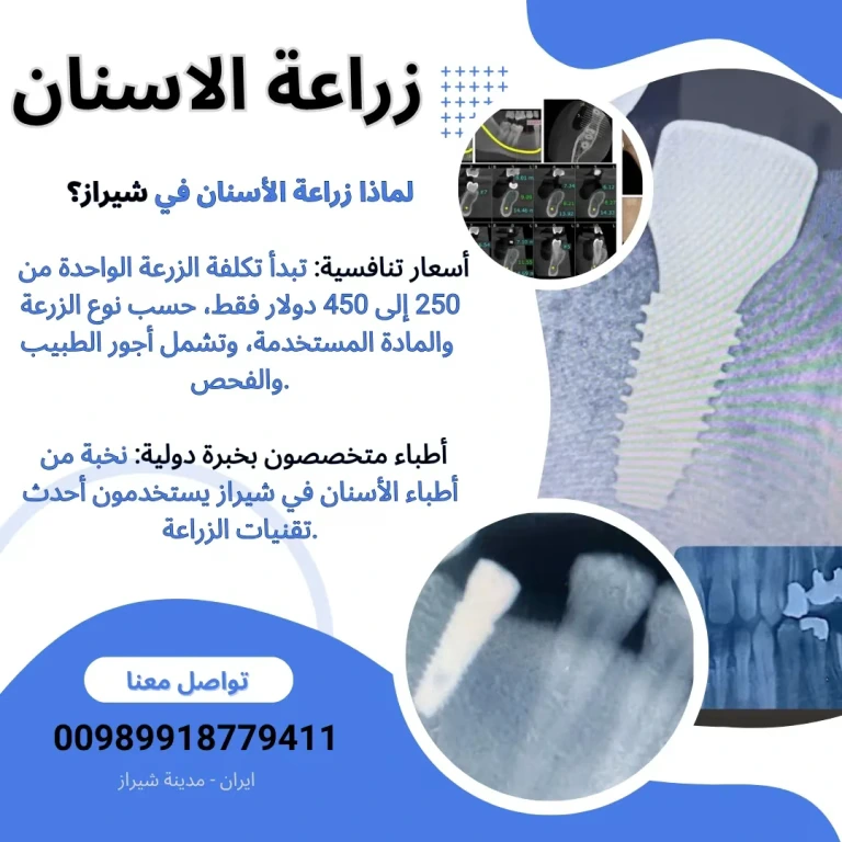 زراعة-الاسنان-في-ايران-شيراز