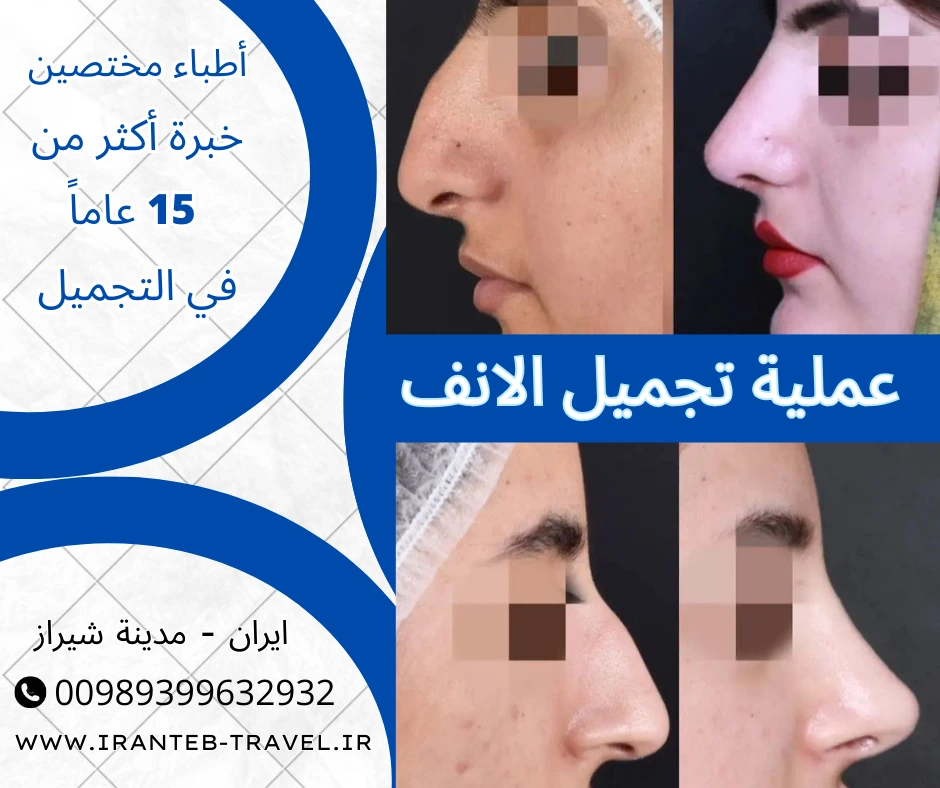 عملية-الانف-في-ايران