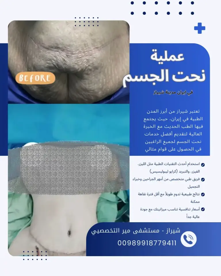 عملية النحت في ايران