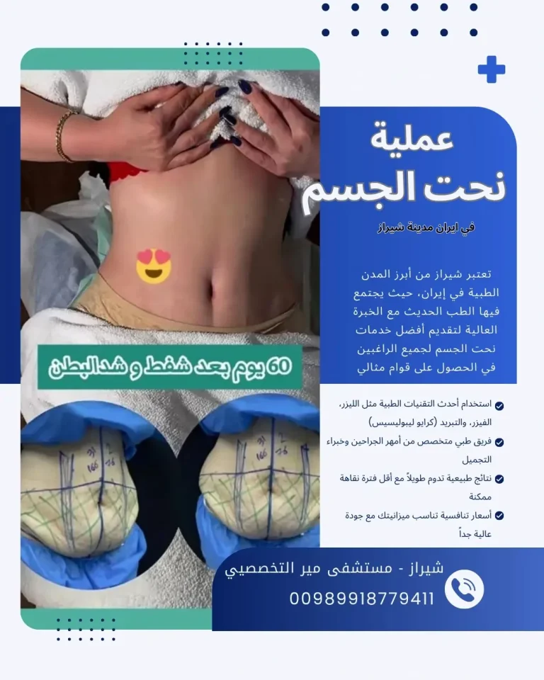 عملية نحت الجسم في ايران شيراز
