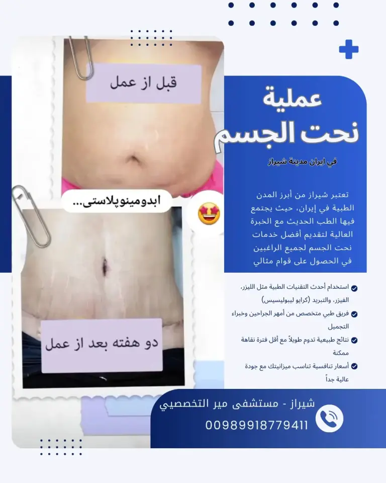 عملية نحت الجسم في ايران
