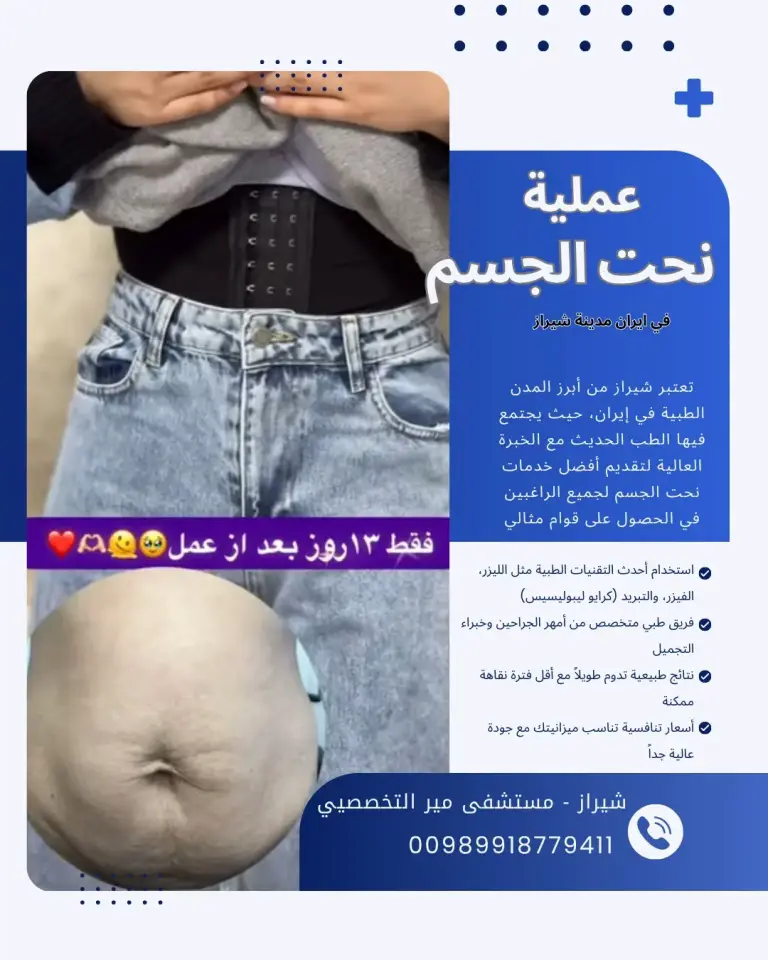 نحت الجسم في ايران