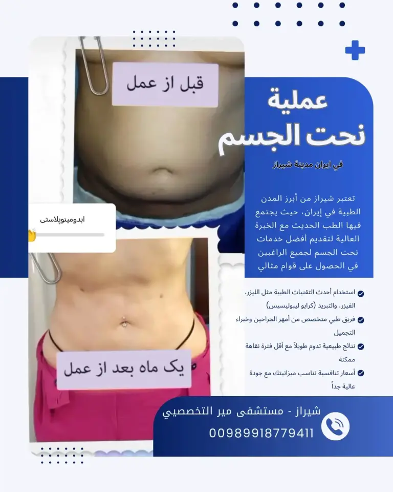 نحت الجسم في ايران شيراز